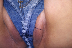 blote kut 8